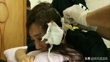 她靠古装美人大火,被狗咬毁容后,如今41岁靠“坏女人”翻身