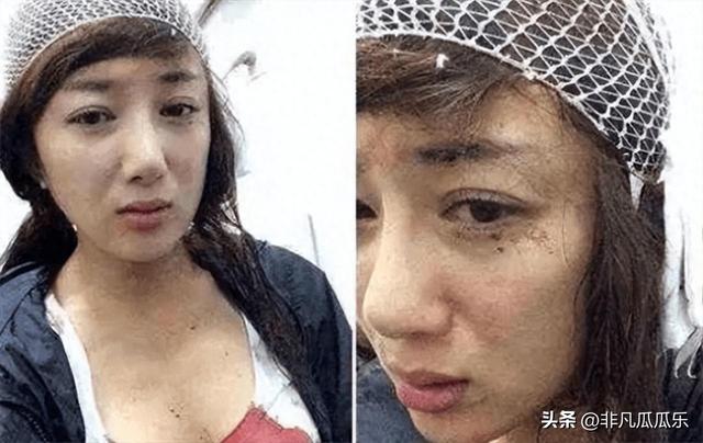 她靠古装美人大火,被狗咬毁容后,如今41岁靠“坏女人”翻身