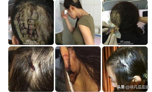 她靠古装美人大火,被狗咬毁容后,如今41岁靠“坏女人”翻身