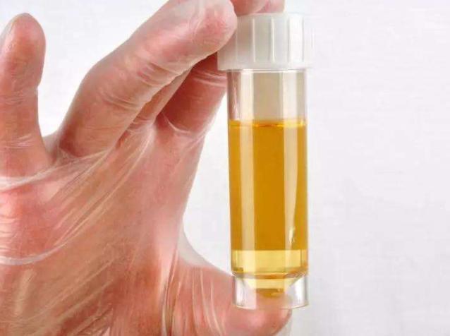 女性内裤上的黄色分泌物,到底是什么东西?早了解早受益