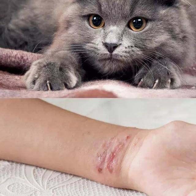 ​养猫一族注意了！猫咪带菌会感染人，这种病全球每年发病人数超过4万例